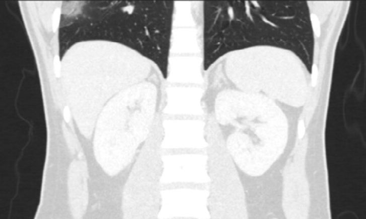 @RadiologyEditor tweet media