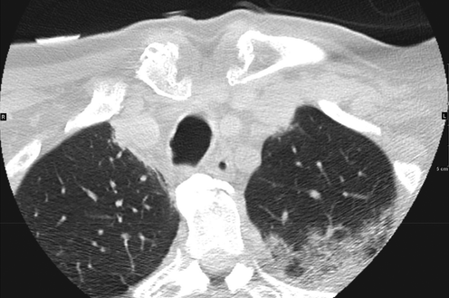 @RadiologyEditor tweet media