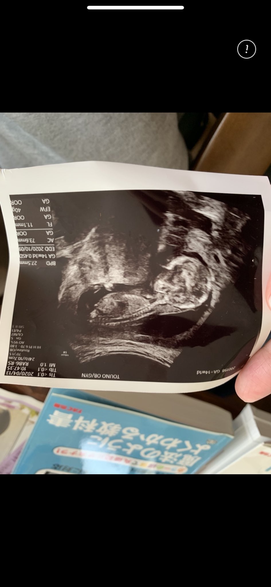 妊娠さん26w 女の子でしょうか 泣 ベビーナブ 妊娠さん26w 女の子でしょうか 泣 ベビーナブ