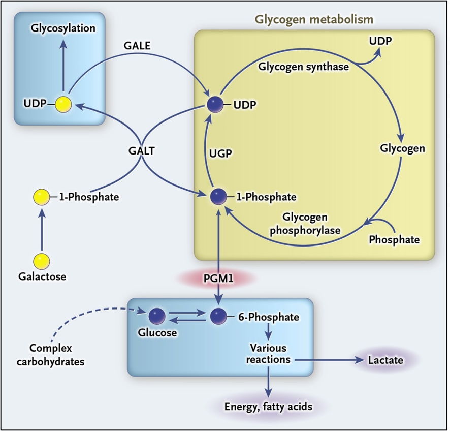 FrontierCDG's tweet photo. Regarding #CDGAwareness 💚, #PGM1-#CDG is another treatable disorder. First known as a glycogen storage disorder, in 2014 several investigators who are now part of the #FCDGC consortium (@emoravakozicz, @FreezeHud, etc) described it as a CDG in @NEJM read: https://t.co/pY6Qjbu0RC https://t.co/dJ1ZdTeC2w