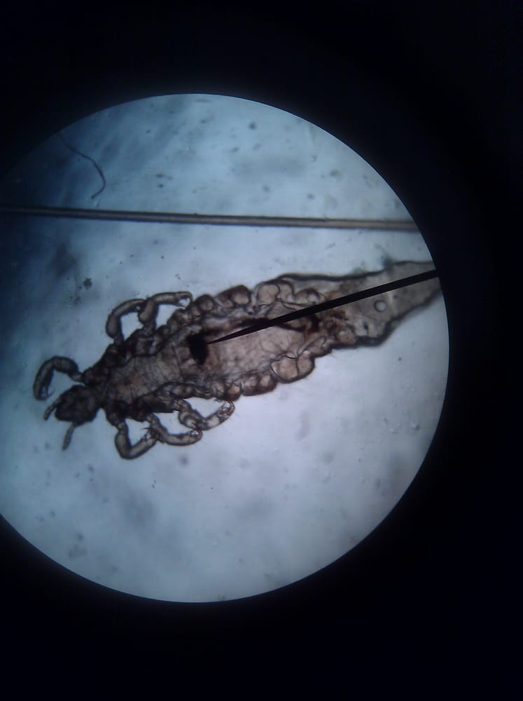 headlicegurucom's tweet photo. This little louse was put in the freezer for 2 hrs and when we took it out it came back to life in less than 30 sec! Yes they resurrect! They can suspend their central nervous system for up to 12 hrs. AMAZING! #moms #SAHM #SAHD #COVID19 #ParentingInAPandemic #CoronaVirusUpdate https://t.co/Y5YDZcO3gk