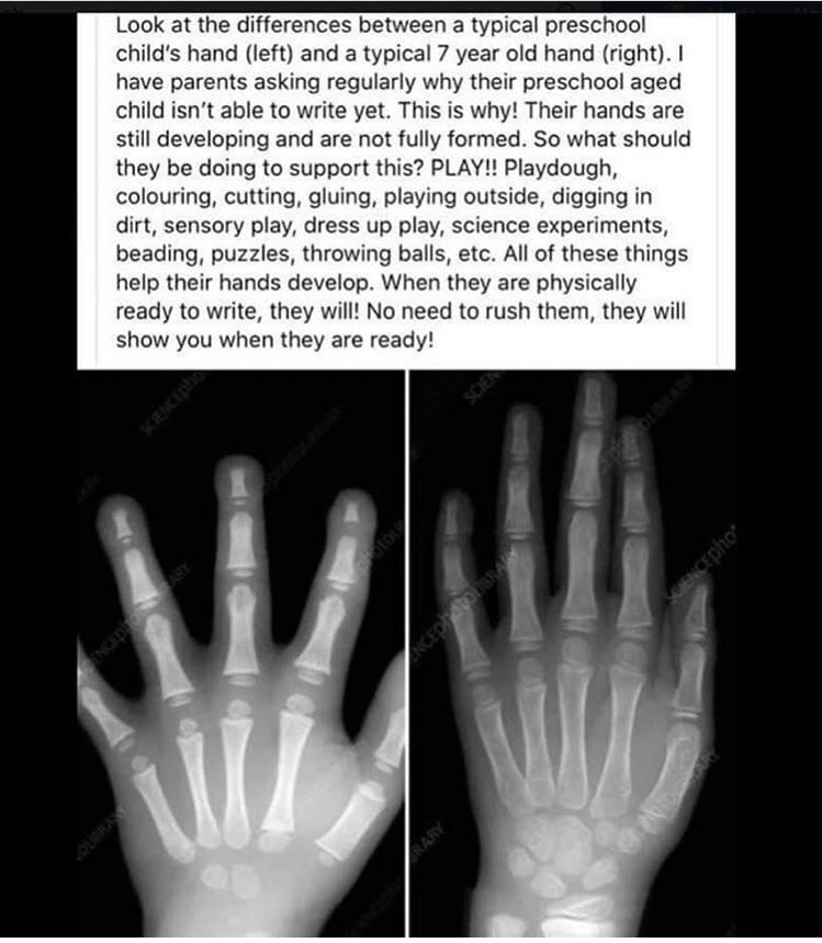 Why PLAY? children’s development relies on it. #importanceofplay #cisinspires #childrensdevelopment #playmatters