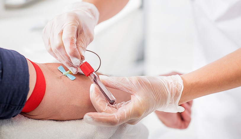 Chronicmeet's tweet photo. Study shows that men have higher concentrations of angiotensin-converting enzyme 2 in their blood that enables the #coronavirus to infect healthy cells. Thus, men are more vulnerable to #COVIDー19 than women - https://t.co/FrhSYuuafN

#chronicillness #research #TestingForCovid19 https://t.co/jrFMdo4246