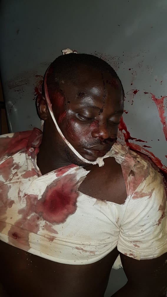 "That's my junior brother pulled out from the house and brutally killed by the military. He has never been an Amba fighter. Where do we run to",
The brother ot the victim exclaims
#GenocideInSouthernCameroons
 <a href="/UKParliament/">UK Parliament</a> <a href="/DavidDavisMP/">David Davis MP</a> <a href="/hrw/">Human Rights Watch</a> <a href="/CNN/">CNN</a> <a href="/LBC/">LBC</a>