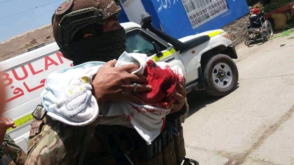Yousafzadrn's tweet photo. Sorry for these bloody Photos.
But this is #Kabul attacks where a hospital has been targeted by militant.
#Afghanistan
#War
#Waching
@UN @US4AfghanPeace @USAmbKabul https://t.co/AP1wzrJVMY