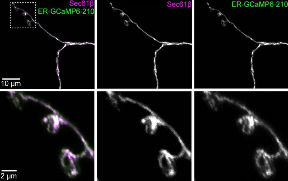 A genetically encoded Ca2+ indicator targeted to the luminal ER is used to measure intracellular Ca2+ dynamics at axons and nerve terminals in tonic and phasic neurons prelights.biologists.com/highlights/end…

First preLight by @QuinonesFrias on preprint from @Megankoliva @OKaneCahir & co.