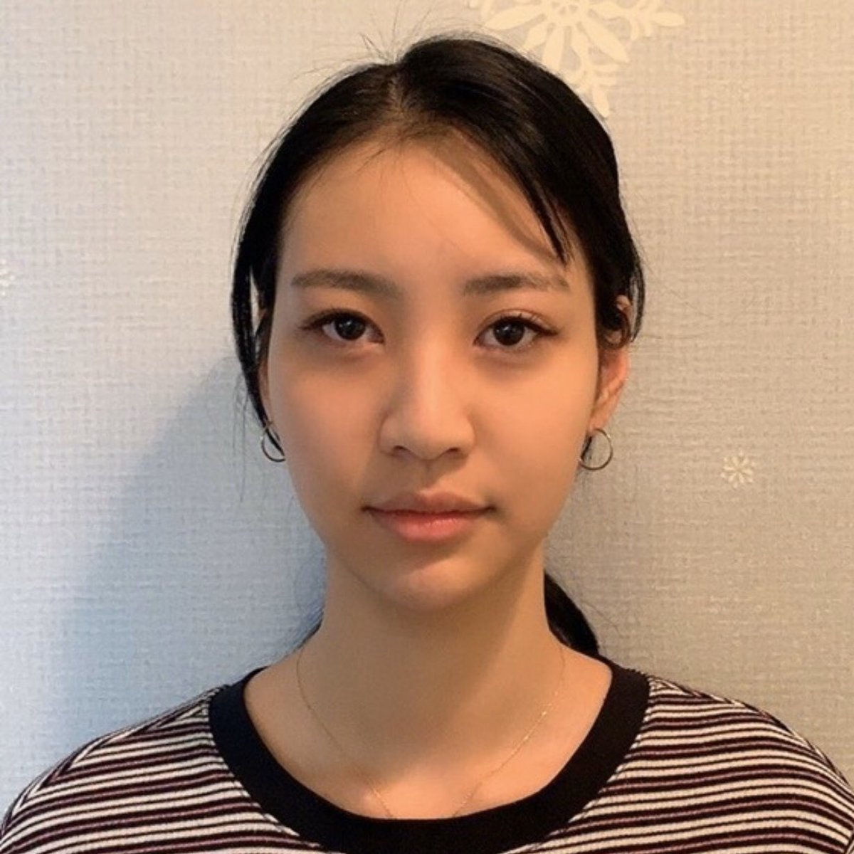 韓国整形エージェント Kbm お化粧が楽しくなる 二重手術を受けた方の ビフォーアフター 今なら 手術予約でエルメス Get 無料で病院紹介やオンラインカウンセリングも受けられます お問い合わせはkbm公式lineまで T Co