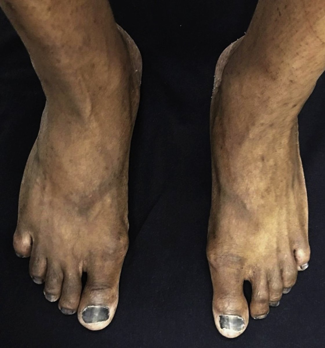 JAAD Journals tweet media