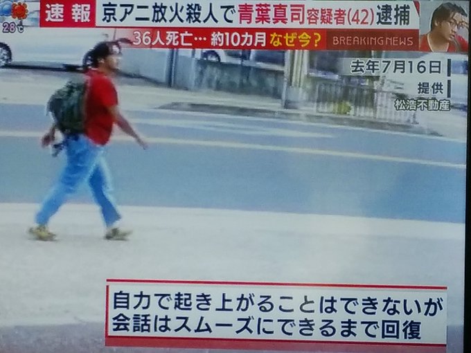 京アニ放火 青葉容疑者の火傷がひどい 手の指が変形してる 画像などまとめ まとめダネ