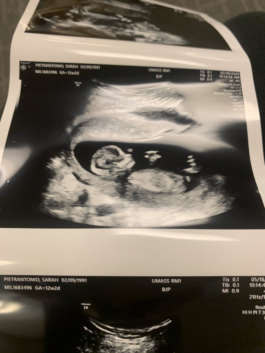 butt3rCup0906's tweet photo. Baby P 🥰🤰🏻@HubbyWubbyBunz https://t.co/1ZdJVljfxl