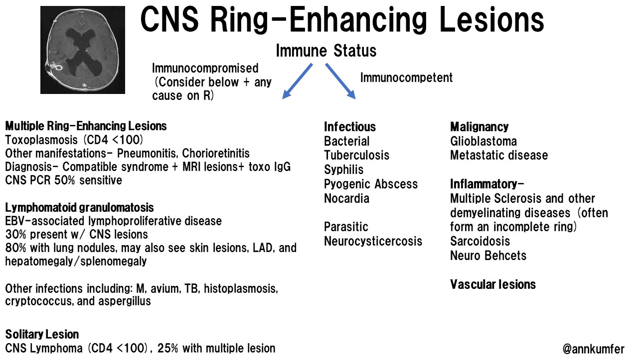 CNS Ring-Enhancing Lesions - Immunocompromised vs Immunocompetent Multiple  ... | GrepMed