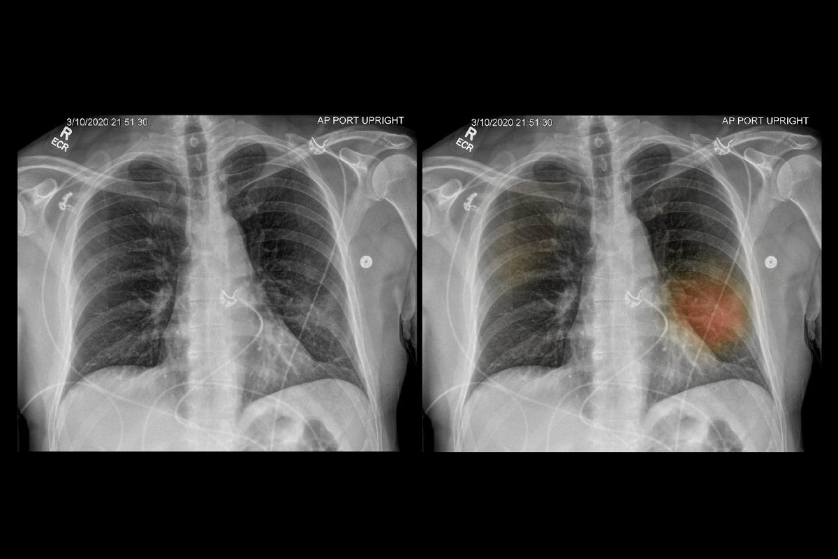 JerzyBiernacki's tweet photo. The #coronavirus crisis has inspired some hospital systems to accelerate promising #ArtificialIntelligence applications that have not been properly tested and validated. 
Do you think pandemic is the right time to test AI-based solutions? https://t.co/T3Sn2S1UuK
#MachineLearning https://t.co/7XGrPUwy4K