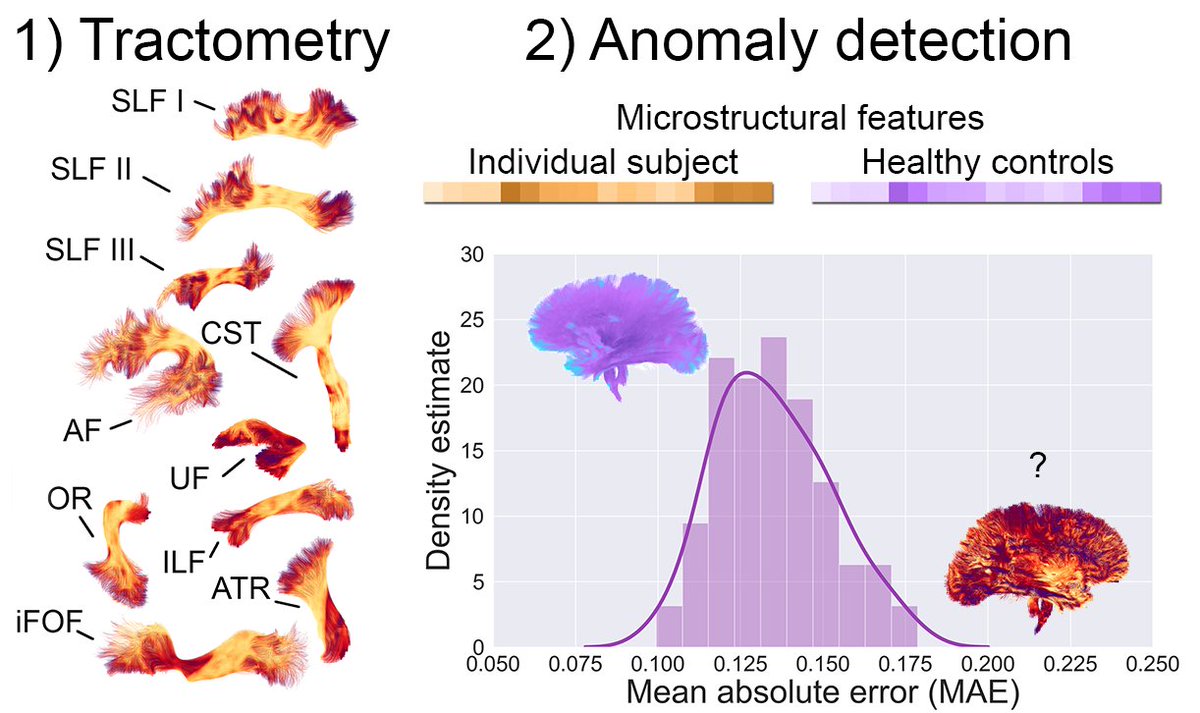 MaxChamb's tweet photo. Check out our recently accepted @midl_conference short paper which combines #DeepLearning and diffusion MRI #tractometry for single-subject anomaly detection #MIDL2020 (link: https://t.co/1AXs93mV0k) https://t.co/mw8PbAblXI