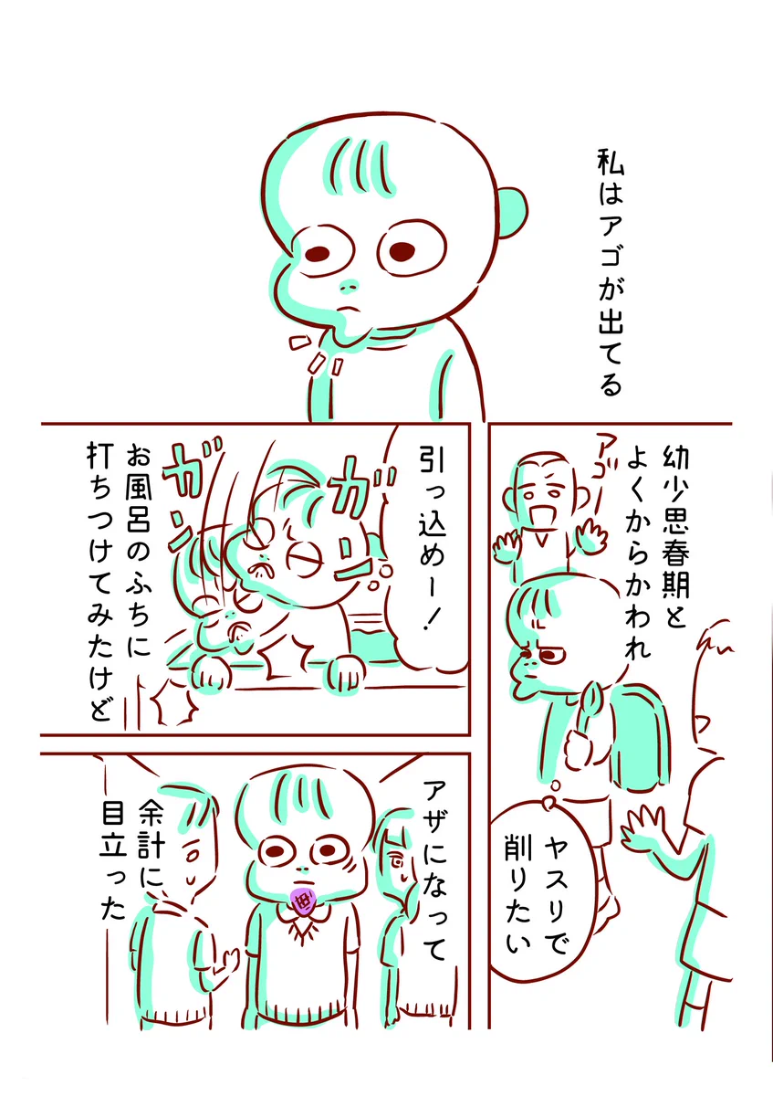 「そこが好きだけど?」アゴがコンプレックスだっだ女性の辛い日々が浄化された瞬間