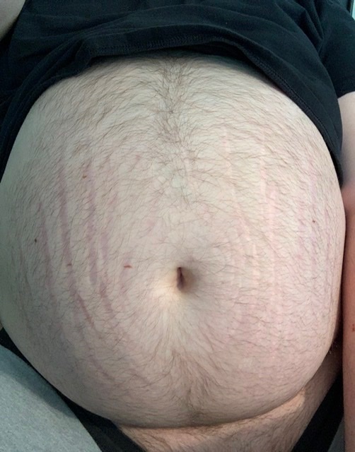 irishjuke's tweet photo. *HIC* whaaat a niight
#beerguts #bigbelly #beergut https://t.co/KZ9NFWyRE5