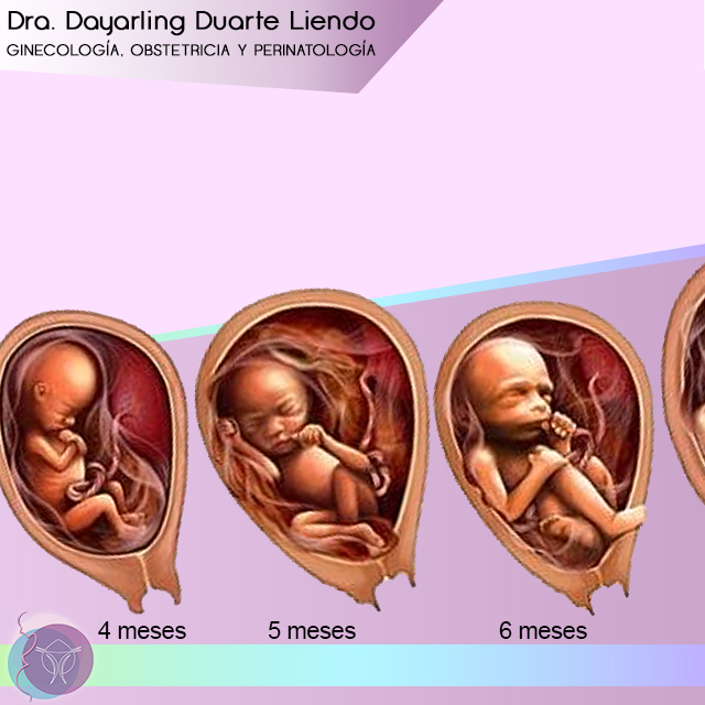 dra_liendo's tweet photo. Así de mágico y maravilloso es el crecimiento de tú bebé dentro del útero.
Siempre recuerda, no hay manera de ser una madre perfecta, pero si hay un millón de maneras de ser una buena madre.
#embarazo #mesAmes #cesarea #Venezuela @pcmetropolitana @clinicaracas #draliendo https://t.co/RXILTWh6F4