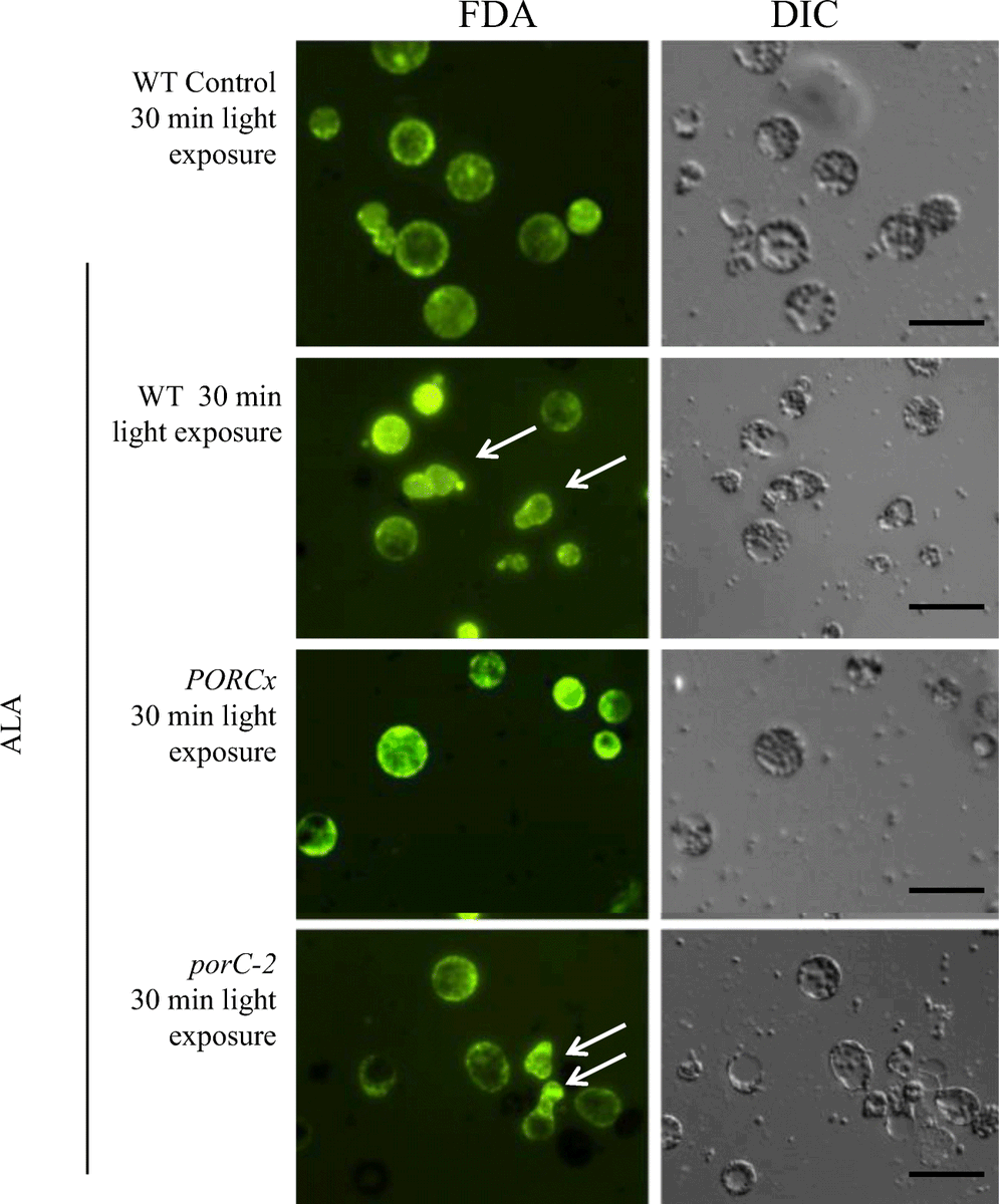 SpringerPlants's tweet image. Vivek Ambastha, Garima Chauhan, and colleagues report the execution of #programmedcelldeath by #singletoxygen generated inside the chloroplasts of #Arabidopsis thaliana.

Read the article published in the current issue of Protoplasma.
link.springer.com/article/10.100…