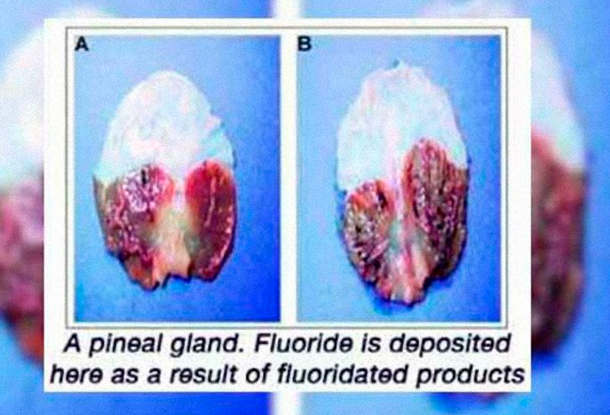 Ils veulent détruire la Glande Pinéale...Avec le Vaccin Covid EY4NdCFWkAEPWvz