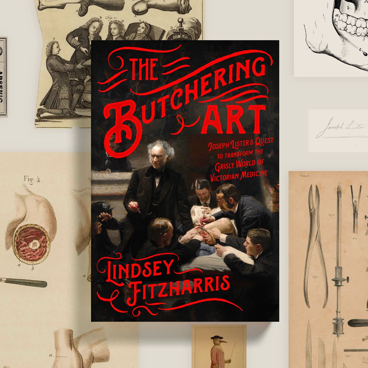 (16/16) Some of you have asked when the next book will be released. A book of this nature takes several years to research and write, but rest assured I’m hard at work. In the meantime, might I point you to  #TheButcheringArt, about Victorian surgery:  https://amzn.to/2S4nR5I 