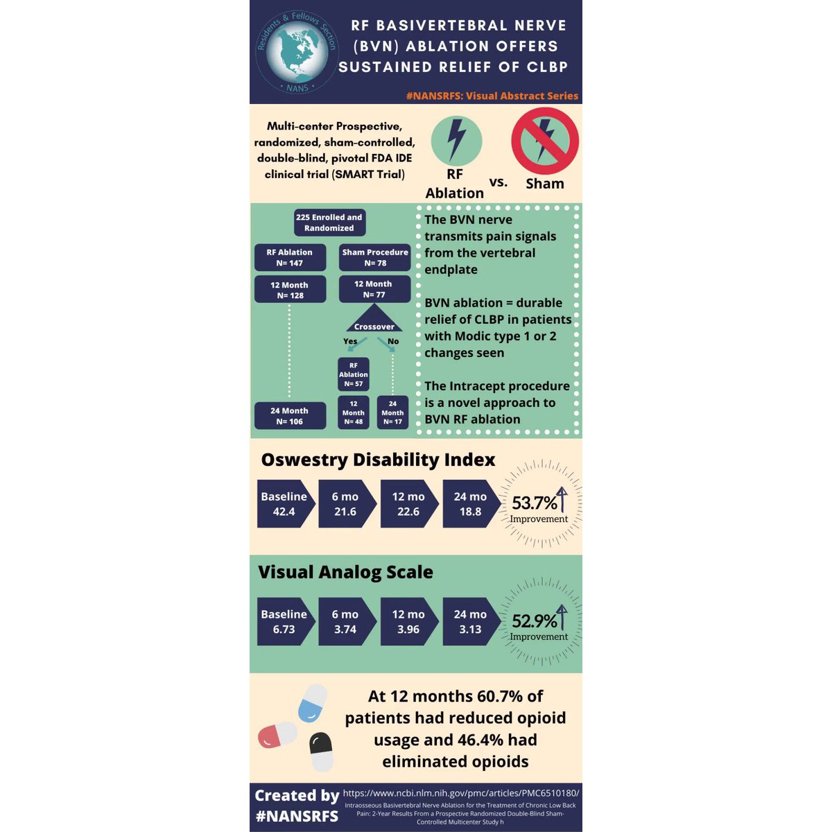 NANS-RFS & Young Neuromodulators (@nansrfs) on Twitter photo Featuring our latest #VA by <a href="/BryanWhitlowMD/">Bryan Whitlow</a> from <a href="/UNC_Anesthesia/">UNC Anesthesiology</a> featuring 2019 Fischgrund et al. study “Intraosseous Basivertebral Nerve Ablation of Chronic Low Back Pain: 2-year Results From a Prospective Randomized Double-Blind Shan-Controlled Multicenter Study”. Featuring our latest #VA by <a href="/BryanWhitlowMD/">Bryan Whitlow</a> from <a href="/UNC_Anesthesia/">UNC Anesthesiology</a> featuring 2019 Fischgrund et al. study “Intraosseous Basivertebral Nerve Ablation of Chronic Low Back Pain: 2-year Results From a Prospective Randomized Double-Blind Shan-Controlled Multicenter Study”.