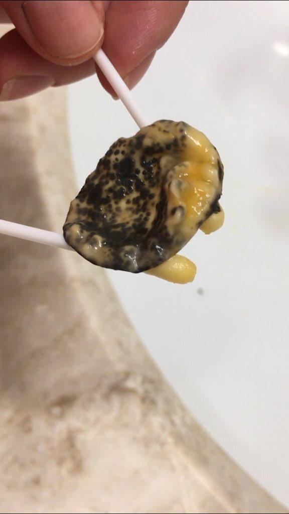 Çileğin içinden çıkan şeye bakın #cilek