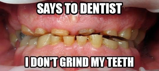 Bad Habit #4:  #Grinding ; good for the hustle but bad for the teethCut down on stress levels, reduce caffeine and alcohol intake, don’t chew on non food items!Visit your dentist and we’ll consider treatment options based on the reason. Mouthguards are commonly recommended!