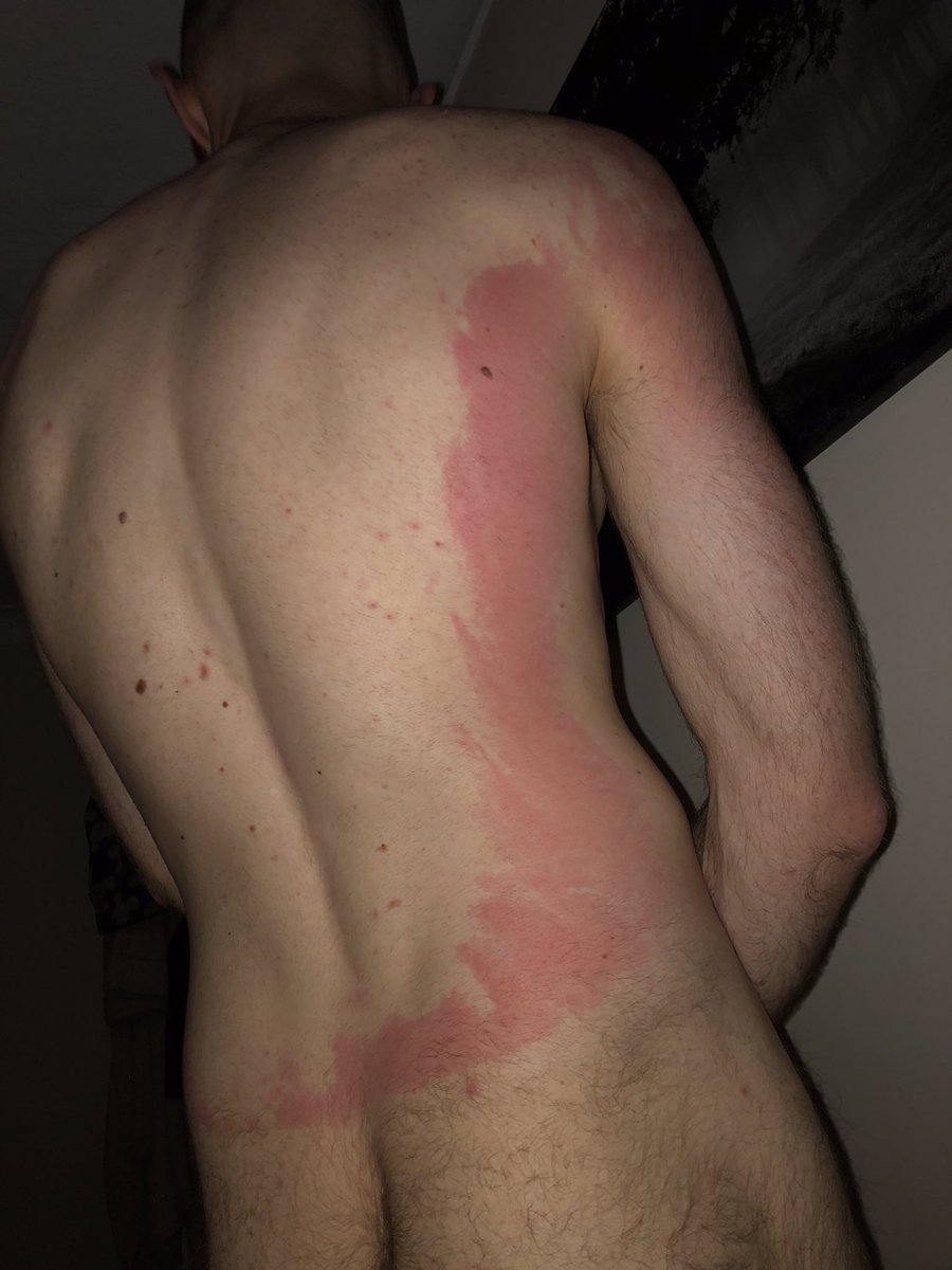 RAB060189's tweet photo. Can’t decide if I hate Cummings or Coxford more right now.. I had to drive over 200 miles.. I’ve put sun cream all over your back.. 🤷🏻‍♂️ https://t.co/k42V7pLmCp