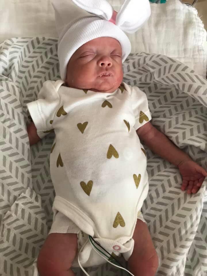 LeepsNBounds's tweet photo. Tube free!! We only have our feeding tube and it will be through the nose now! She is amazing! #HarveyMarie #BigGirlMoves #TubeFree https://t.co/8RBVffqEQW