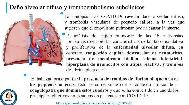 MatildeH_UCE's tweet photo. Fisiopatología de la Enfermedad Causada por el #SARSCoV2 #Covid19Ec Parte 2 https://t.co/N9AbHb5uZG