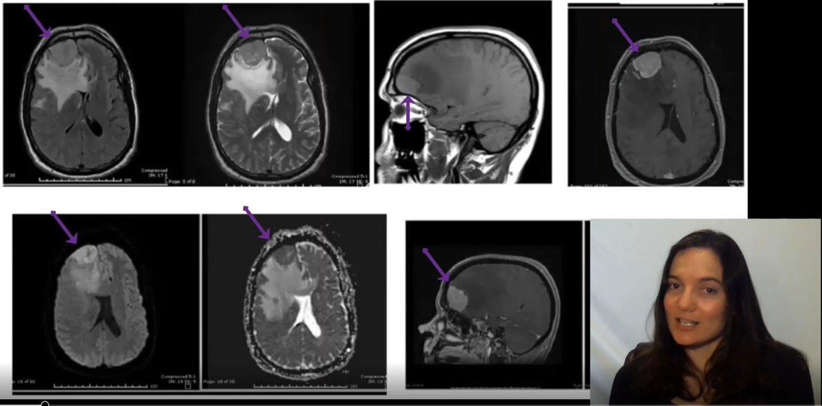 Adventures in Neuropathology tweet media