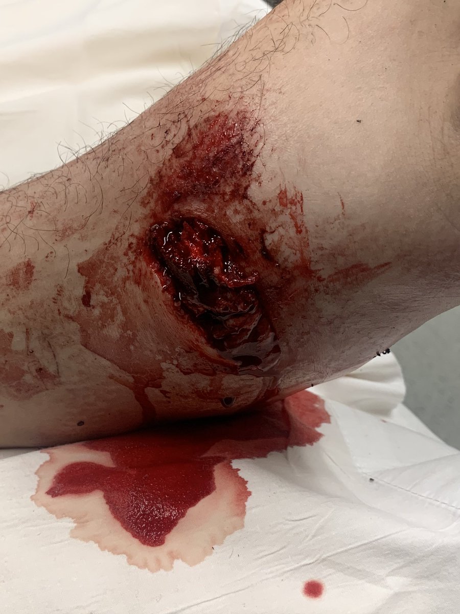 Norstee70's tweet photo. I think it might be time to retire the ole dirt bike🥺 https://t.co/zgqa4gaHWM
