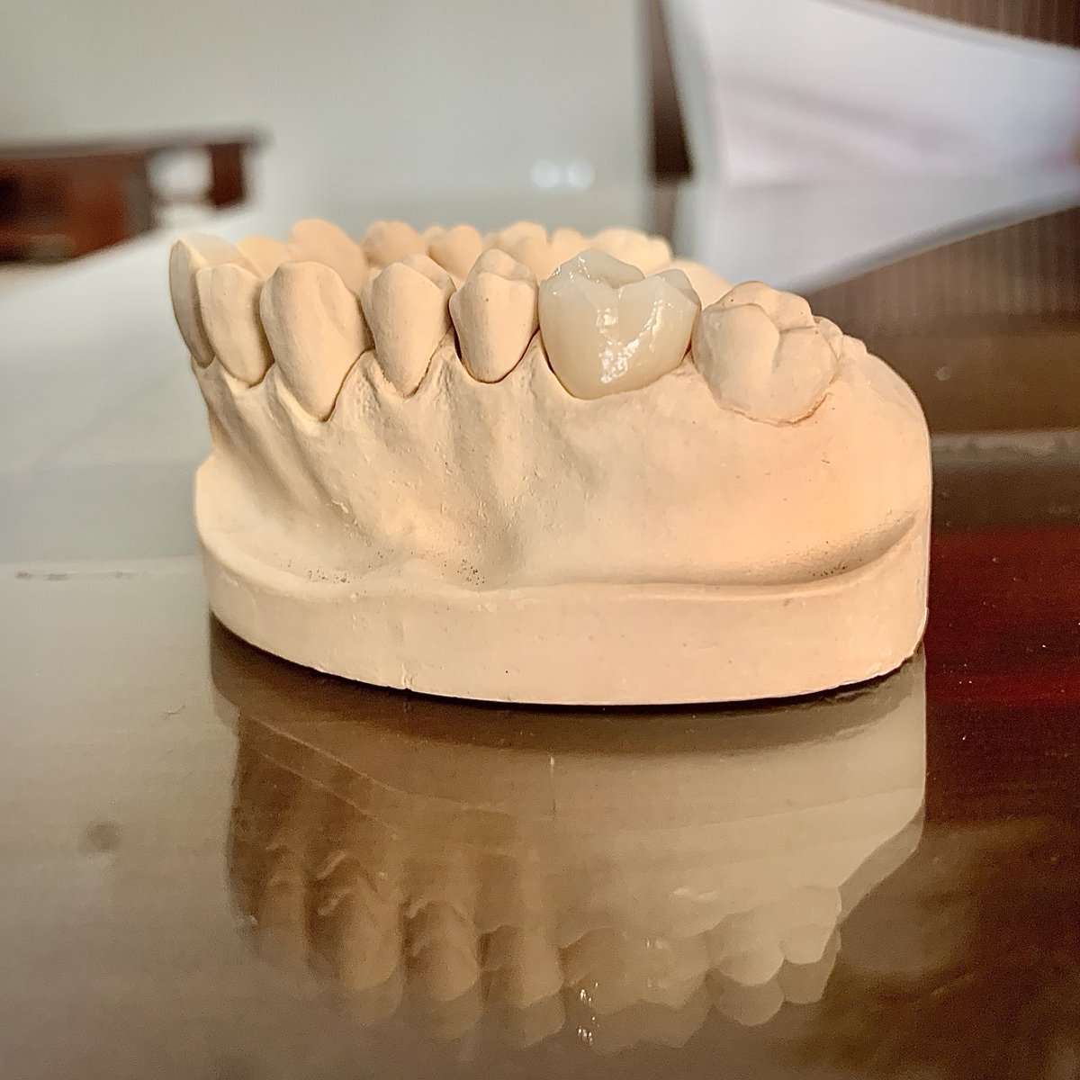 lab_vu's tweet photo. Emax Crowns done at Vu Gia Dental Lab this week
#Vugiadentallab #Hanoi #Vietnam #dental #dentistry #fullservice #outsourcing #outsourcingdentallab #dekema #imesicore #Imetric #Trios #Renfert #AmannGirbbach #dentalcare #cosmetic #crown #aesthesis #restoration #emax #emaxcrowns https://t.co/LvlMsbhZ9u
