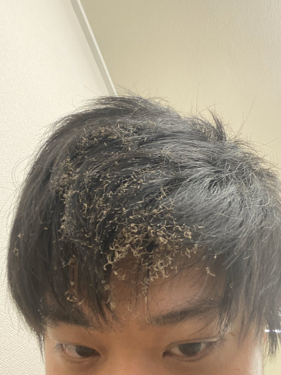 平田 拓己 Samurai Incubate 髪燃えるとこうなるんですね 平田 拓己 Samurai Incubate 髪燃えるとこうなるんですね