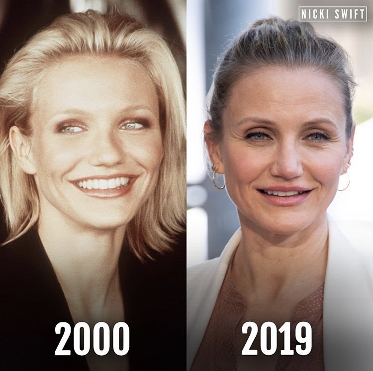 Cameron Diaz Plastic Surgery Before And After