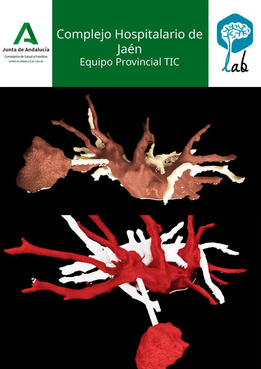 saludtecnolab's tweet photo. We have printed a 3d model for the Thoracic Surgery Unit to assist in surgical planning.
#Thoracicsurgery #ThoracicSurgeons #LungCancer #sublobarResection #3Dmodel #model3D #3Dprinting #3Dprinted @3DSlicerApp #meshmixer @HospitalJaen #Jaen https://t.co/qeiGnik9gR