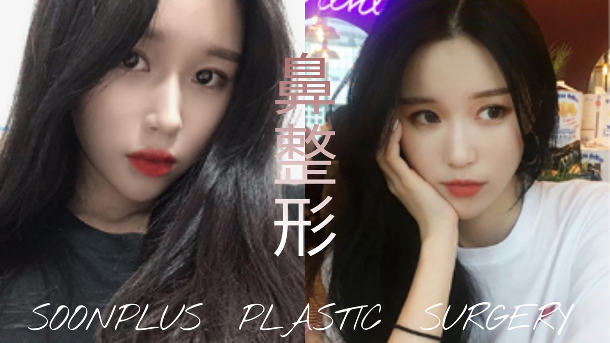 SoonplusJ's tweet photo. ⚘NOSEカスタム鼻整形⚘
春の鼻整形キャンペーン開催中🎁
鼻初手術(鼻筋+鼻先)イベント中💞
詳しくは、スーンプラスLINEまで!
LINEID:soonplus
#スーンプラス #soonplus #韓国整形外科 #韓国美容外科 #アメブロ #鼻整形 #鼻手術 #鼻整形イベント中 #美容整形 #目整形 #団子鼻 https://t.co/4LDg4eZYC2
