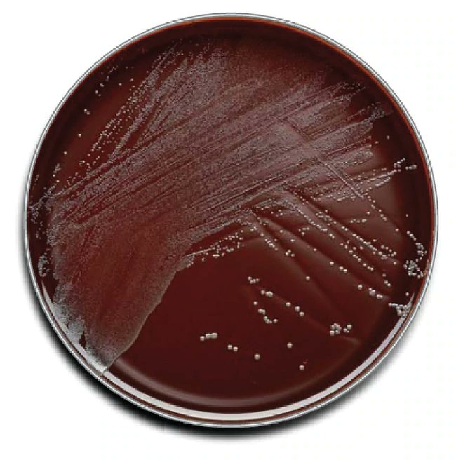 Harry Styles as Bordetella pertussis on Regan-Lowe Chocolate charcoal Agar