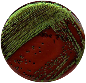 Harry Styles as Escherichia coli on EMB agar