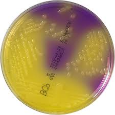 Harry Styles as E. coli on BCP lactose agar