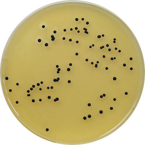 Harry Styles as Staphylococcus aureus on Baird-Parker agar