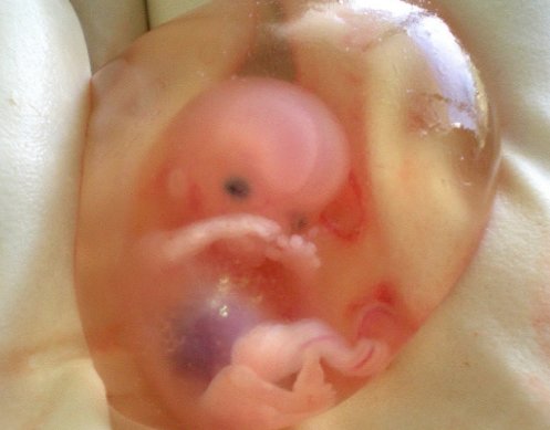 HnoAxel's tweet photo. 12 semanas de gestación, de este tamaño es el ser humano que asesinan en la CDMX en centros de aborto, y ahora pretenden hacerlo también en Guanajuato. Los mexicanos nos unimos para que no se derrame ni una sola gota más de sangre inocente.

#GtoEsProvida https://t.co/G2OmyscXKq