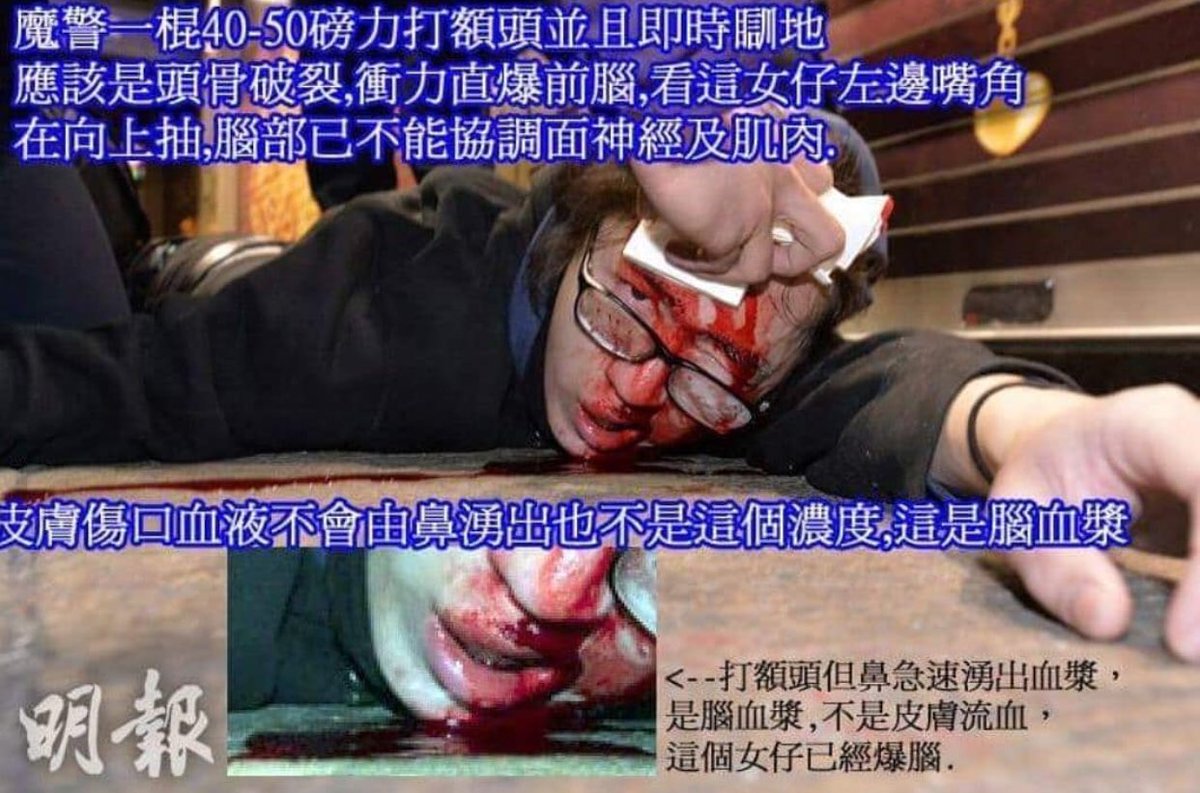 mosifaksun's tweet photo. The forehead of the girl was hit by Hong Kong police but the blood was rash out from the nose .However, the density of the blood is not same with the blood with normal wounds .Therefore it is not normal blood from hit,it is a brain plasma!!!!
that's happened in 2016.... https://t.co/7UpIDO1Jpt