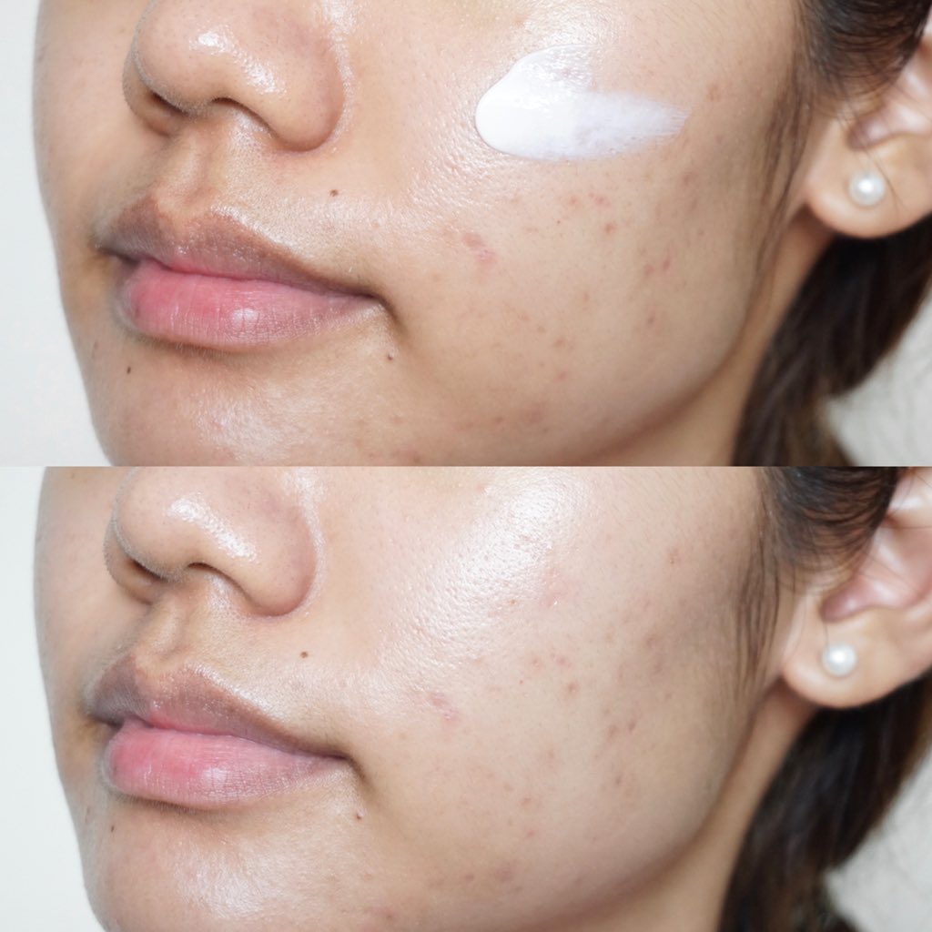 saroreview's tweet photo. #AlphaBright Spot Cream ช่วยเพิ่มความกระจ่างใส ลดจุดด่างดำ ส่วนผสมน่าสนใจมาก เรียกว่า “Triple Whitening Complex” : Alpha-arbutin, Vitamin C, Vitamin B ใช้ทาบางๆทั่วใบหน้า จะช่วยปรับสีผิวให้สว่างขึ้น รวมทั้งเพิ่มความชุ่มชื่นให้กับผิวด้วย ใช้แล้วอย่าลืมทาครีมกันแดดนะ! #cutepress https://t.co/dboiVTJkl9