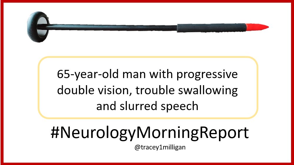  #NeurologyMorningReport Case 43  #MedTwitter Updates & Answers posted later today. Asking your help  #MedEd  #neurology  #neurologyresident  #neurologist  #medstudent  #NeurologyProud  #IamaNeurologist Join me in educating. Share your questions and knowledge. 1/