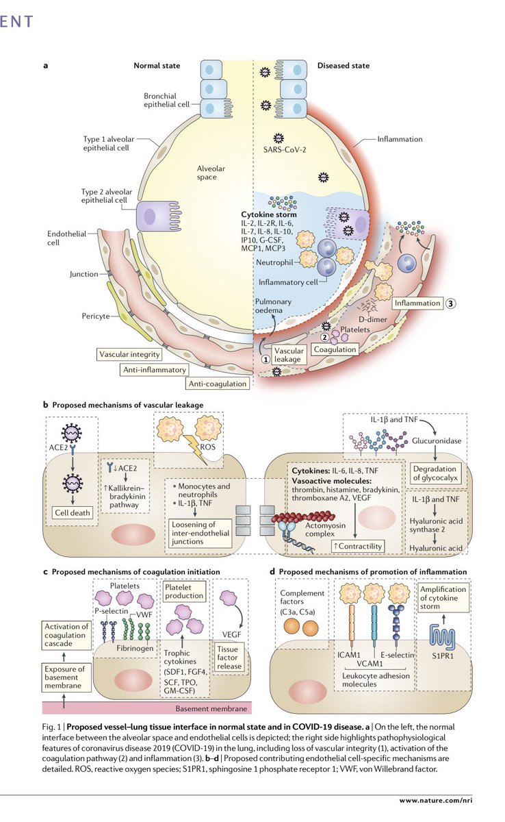 KishoreWary's tweet photo. An emerging hypothesis: #covid19 is a major vascular-disease.  More research is needed to understand the pathogenesis of #coronavirus #nih #nhlbi #niaid @AHA_Research @NIHDirector @GaryGibbonBlog @EuropeanLung @nih_nhlbi @NIHClinicalCntr @jci @nature @CellStemCell https://t.co/u3qtvGnGqy