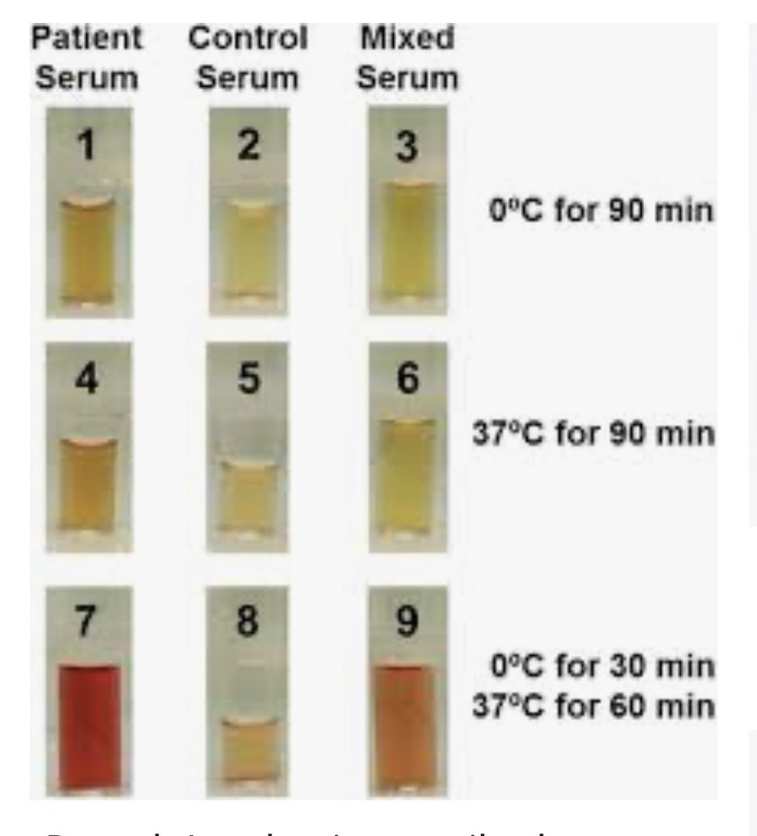 To test for DL, 3 specimens are used. 1. Patients serum 2. Donor serum3. Mixture P+ RBCs are added to each Samples are kept at 4C, then heated to 37C and visualized for hemolysis. Negative controls are kept at 4C and 37C throughout. 8/n