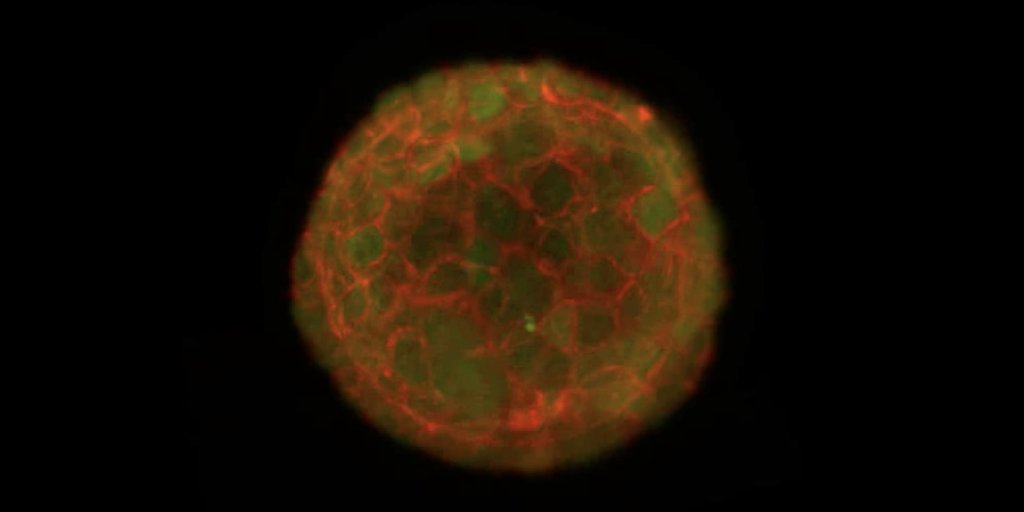 Michael Boutros tweet media