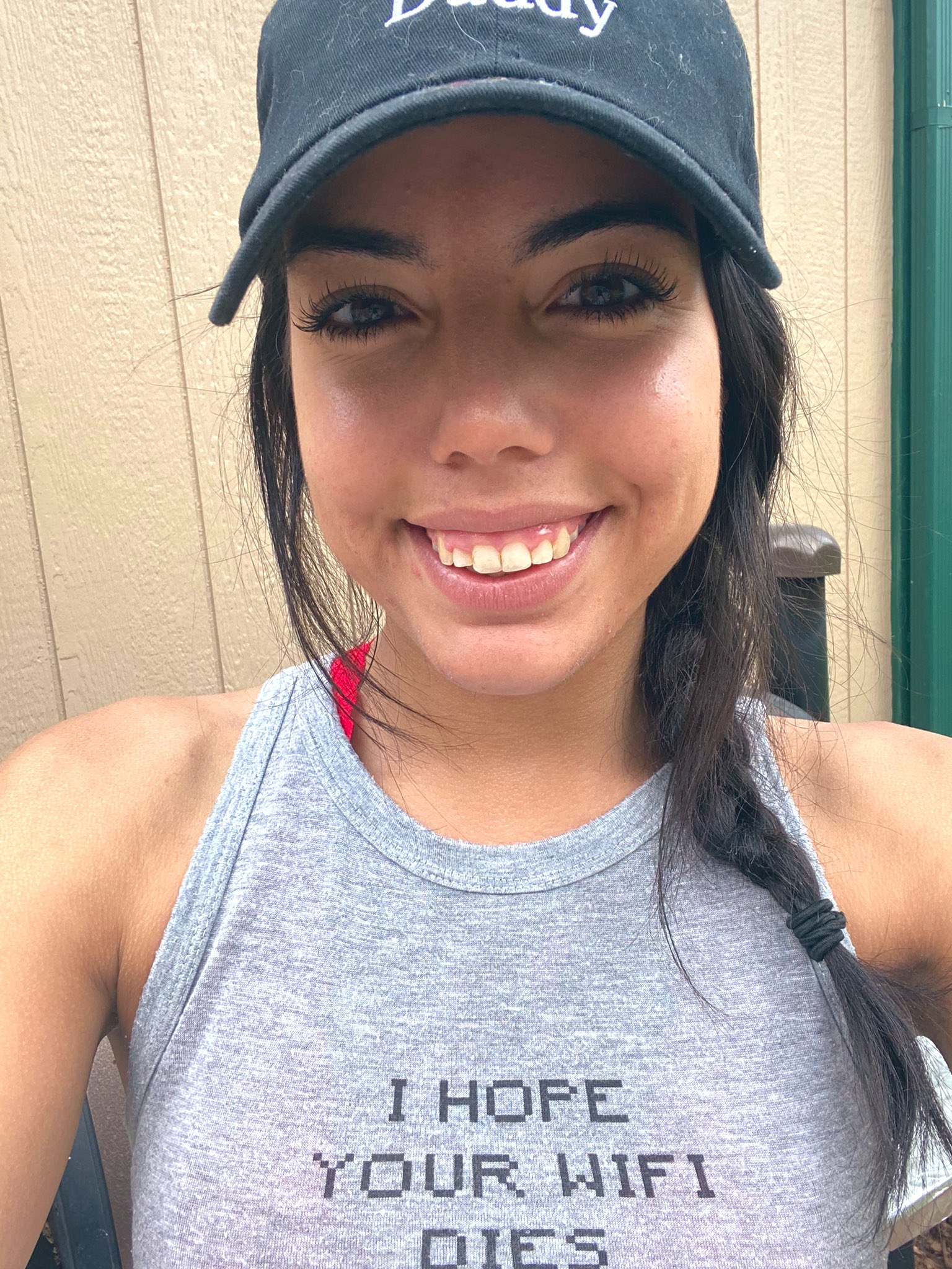 rachel rivers on Twitter: &quot;No more brace face!!!! https://t.co/PzLyfXpKdk&quot;  / Twitter