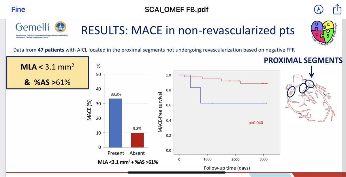 BURZOTTA_F's tweet photo. LATE-BREAKING SCIENCE from virtual #SCAI: #OMEF international collaborative study is out. when combined, simple OCT measures like #MLA and area-stenosis may predict #FFR (and outcome if consrvatively-managed)! Congrats to #roccovergallo, Trani and all OMEF investigators! https://t.co/LibDJzuvKH