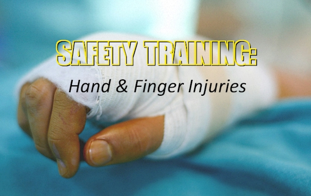 CentralWelding's tweet photo. Our Safety Training topic for “Hand &amp; Finger Injuries” is a good training resource on the risks, hazards, and prevention for injuries of the highest risk in our industry. https://t.co/sQZsMTUqh5 #safetytraining #handprotection #weldingsafety #safetygloves https://t.co/dArr0HoHUD